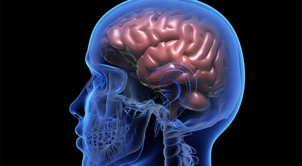 An image of the human brain — the most affected organ in a traumatic brain injury (TBI)